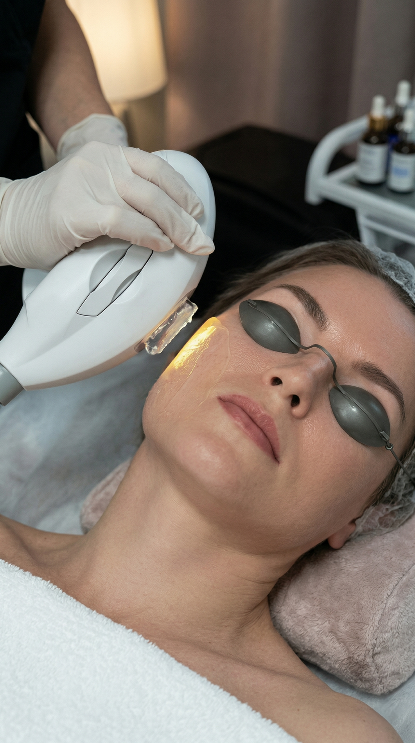 IPL-Photorejuvenation-treatment