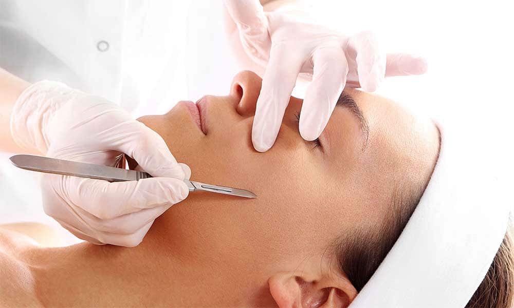 dermaplaning-treatment2