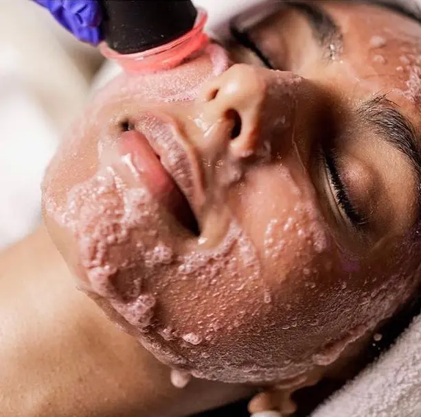 oxygeneo-revive-red-algae-treatment-.jpg